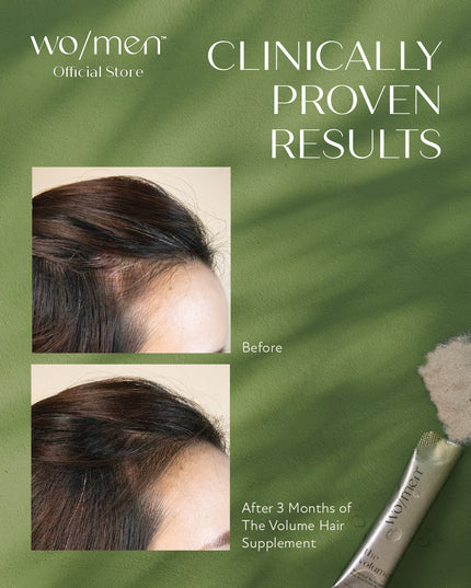 The Volume Hair Supplement